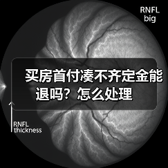 买房首付凑不齐定金能退吗？怎么处理（图2）